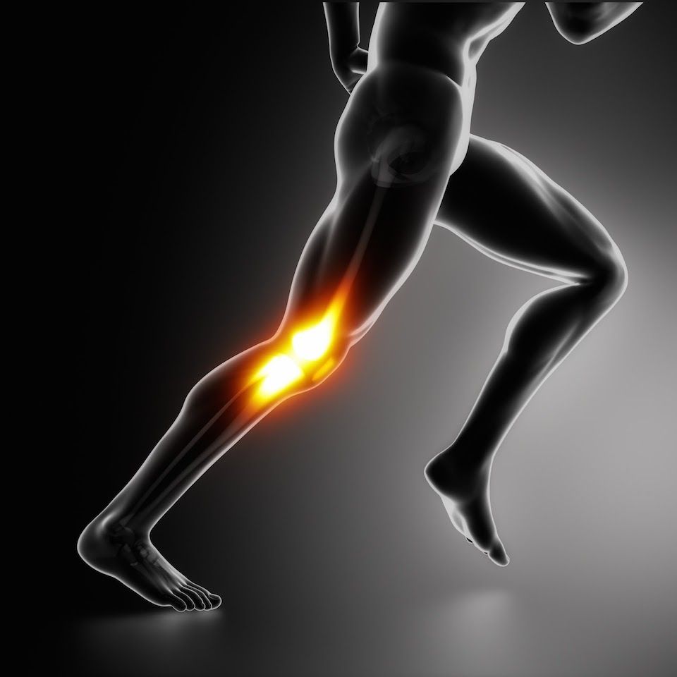 tratamiento condropatía rotuliana fisioterapeuta osteópata Palma de Mallorca