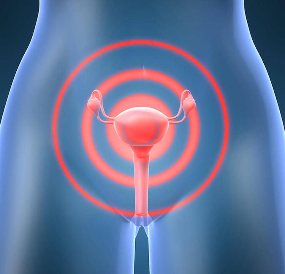 Dismenorrea dolor lumbar tratamiento osteópata Palma de Mallorca