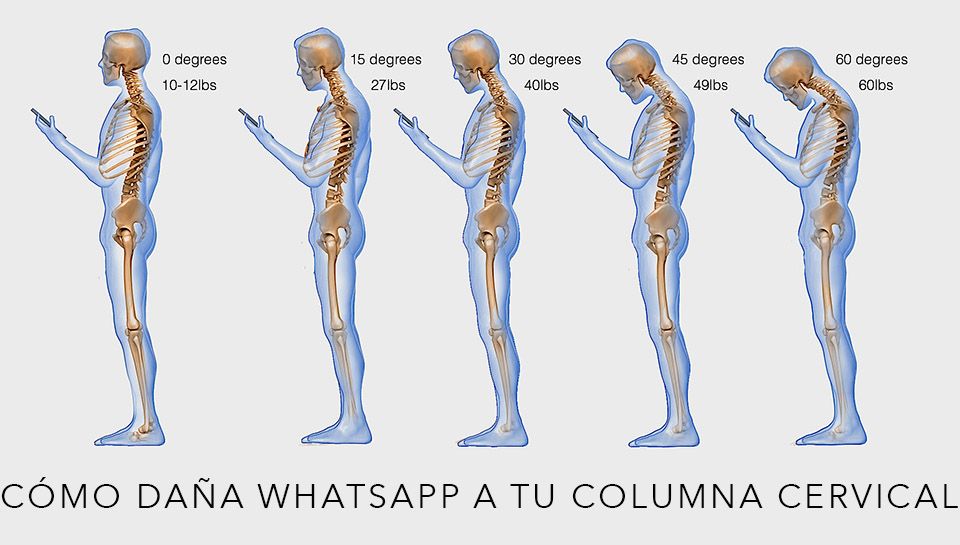 cómo daña whatsapp la columna cervical