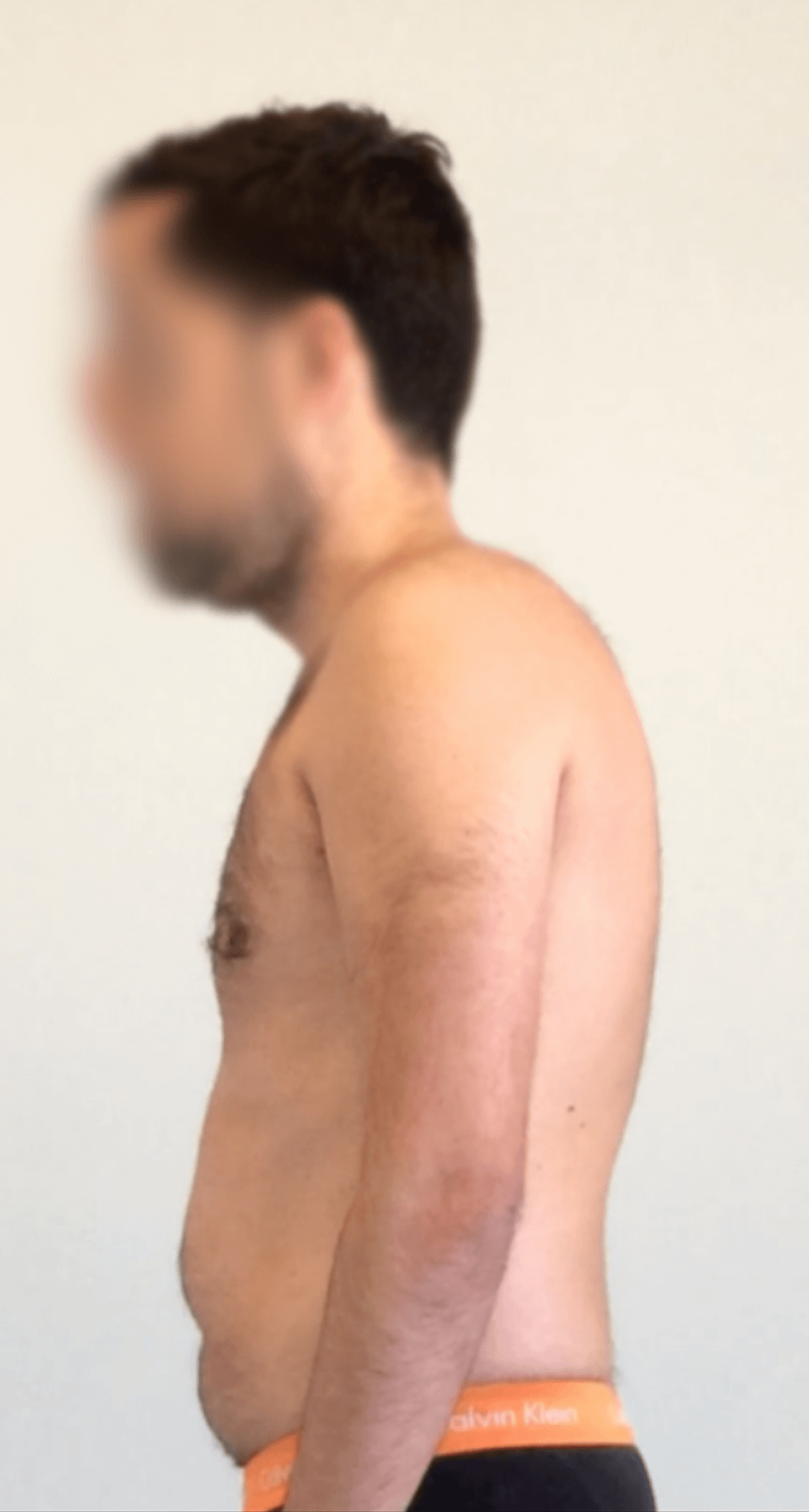 tratamiento de osteopatía dolor cervical tratamiento de fisioterapia y osteopatía palma de mallorca