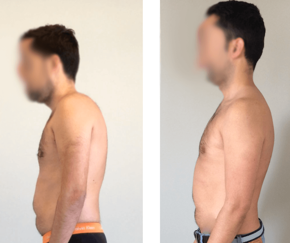 tratamiento de osteopatía-Palma de Mallorca dolor lumbar centro fisioterapia osteópata palma de mallorca