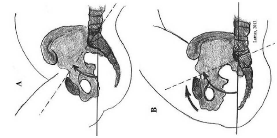 nutacion y contranutacion fisioterapia y osteopatía palma de mallorca