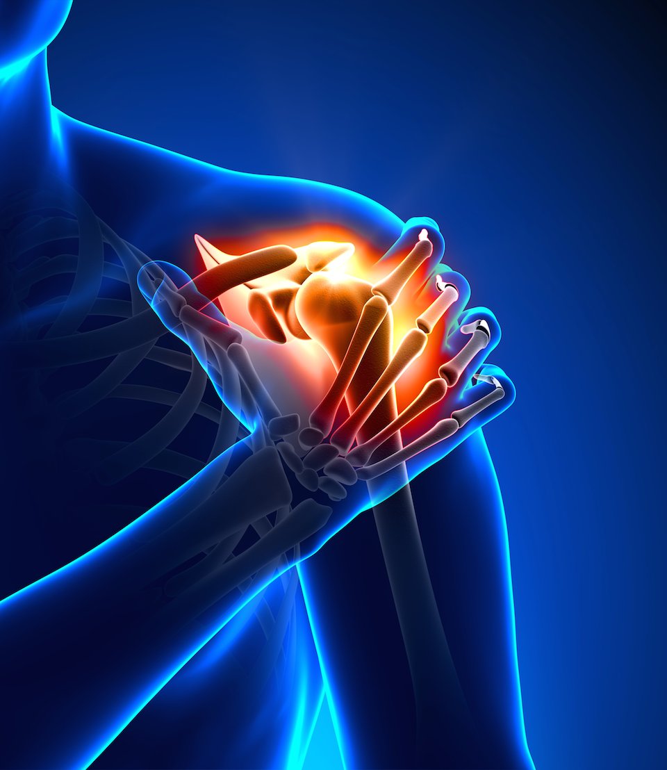 dolor-de-hombro-tratamiento-mallorca-osteopatia